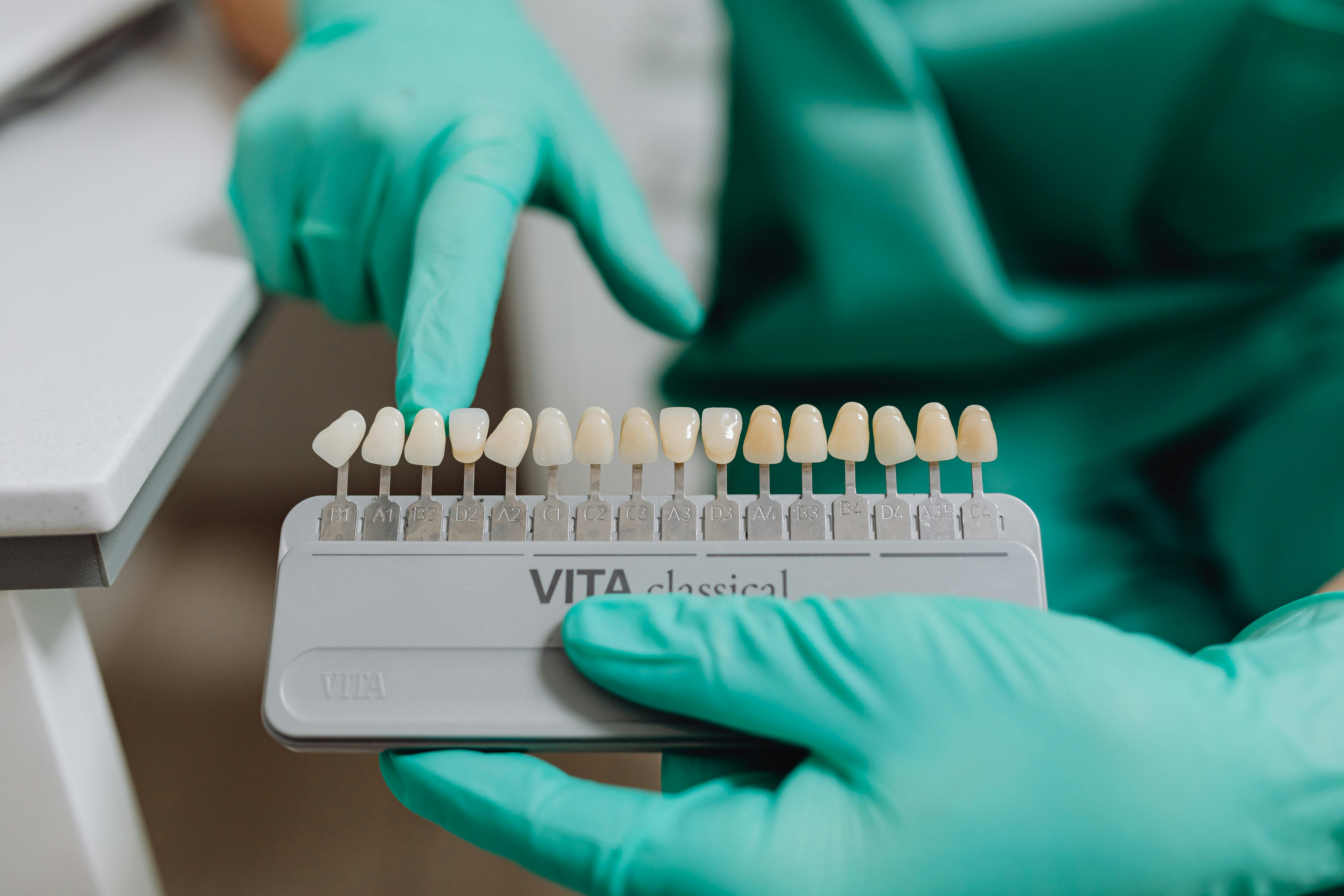 Dents blanches